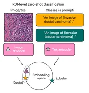 A visual-language foundation model for computational pathology paper image